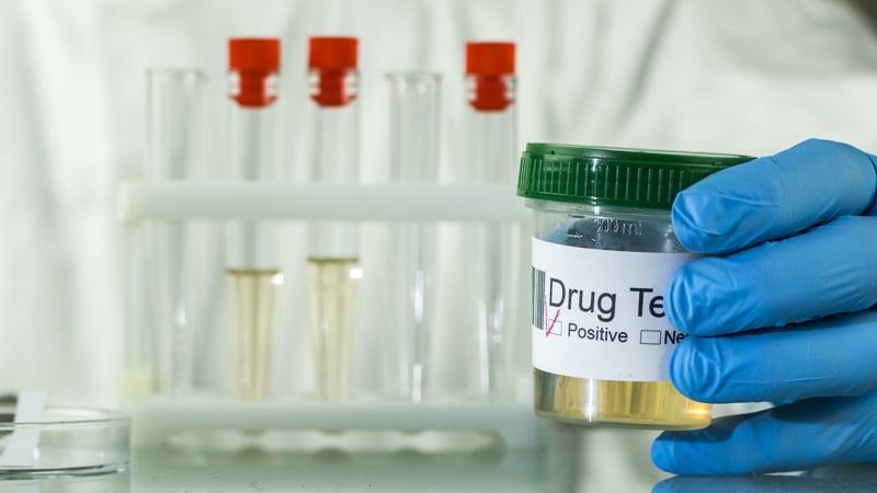 Analysis of urine with a positive result on doping